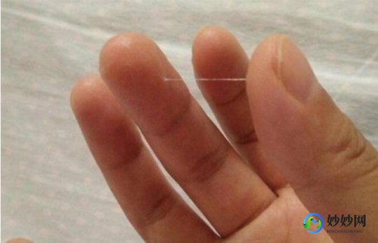 白带不拉丝,白带未拉丝怎么回事