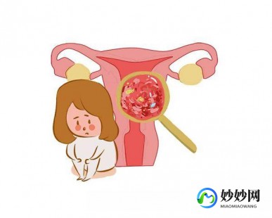 子宫内膜癌的早期症状是怎样的,初期子宫内膜癌的五大征兆