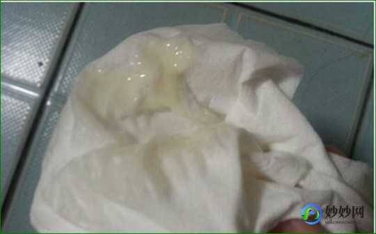 豆渣样白带,豆渣的白带怎么回事