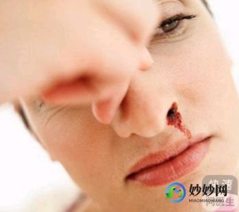 流鼻血怎么治,流鼻血怎么治疗
