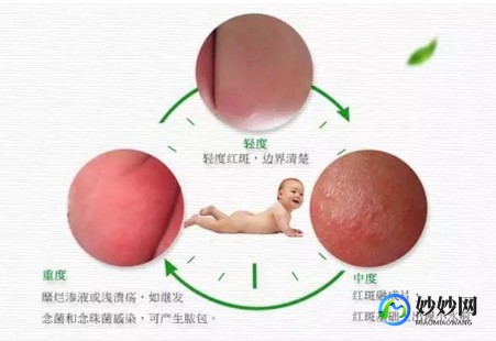 脸上起红疹,脸上突然出现密密麻麻红点