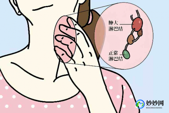 脖子上的淋巴,脖子上有淋巴结吗
