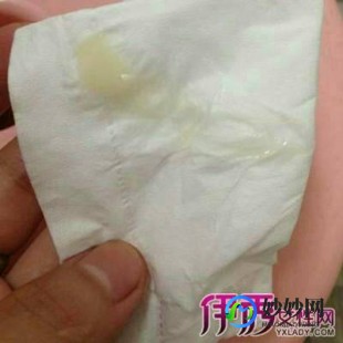 白带不拉丝,没白带拉丝怎么回事