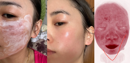 脸部皮肤过敏红肿,脸过敏泛红