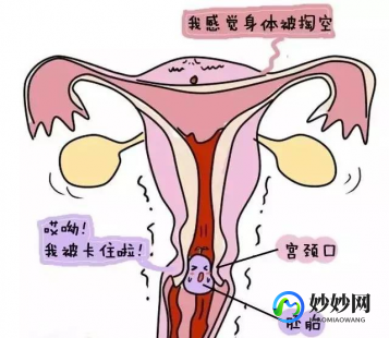 药流三天全部过程,药流三天全部过程是怎么样