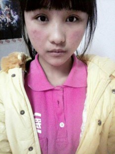 脸发烫,脸发烫是什么原因怎么解决