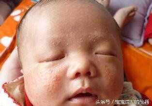 胃出血最佳治疗方法,胃出血怎么办