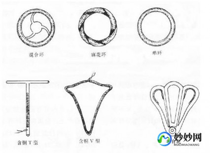 环一定要取吗,环需要取出来吗