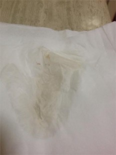 浅褐色,白带呈浅褐色怎么回事
