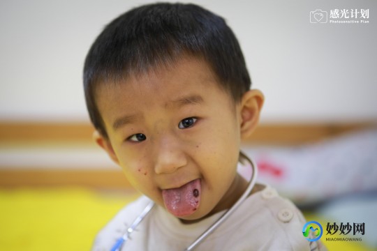鼻血,流鼻血怎么治疗
