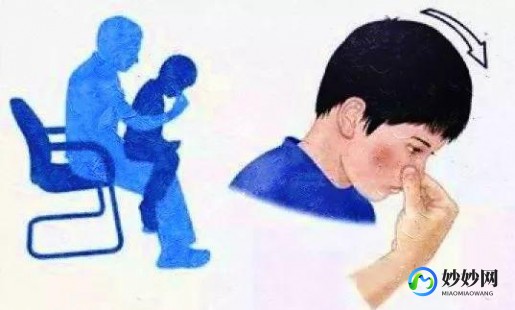 鼻出血怎么办,流鼻血怎么治疗