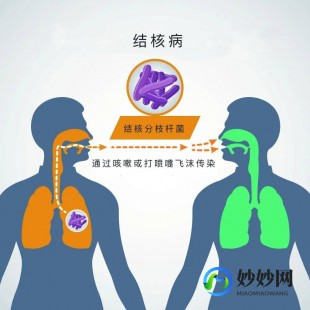 肺结核严重吗,肺结核严不严重