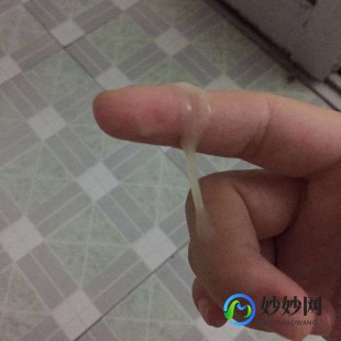 白带像胶水,白带跟胶水似的怎么回事