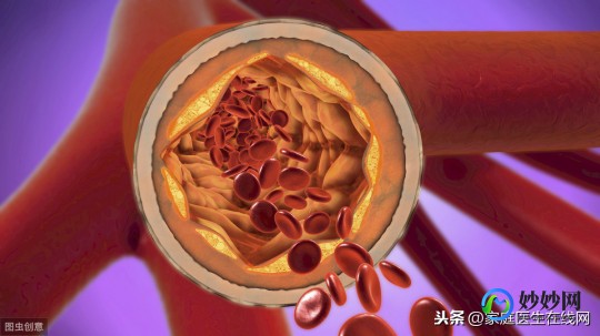 血栓怎么样治疗,血栓治疗的方法有哪些