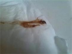 白带褐色有异味,白带褐色带腥味怎么回事