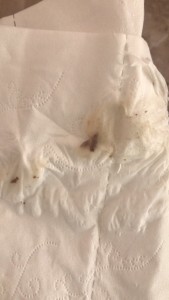 白带褐色有异味,白带褐色带腥味怎么回事