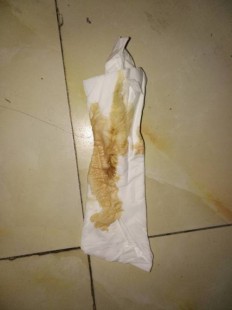 流出液体,下面流液体是怎么回事