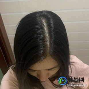 烫头发的危害,经常烫头发的危害