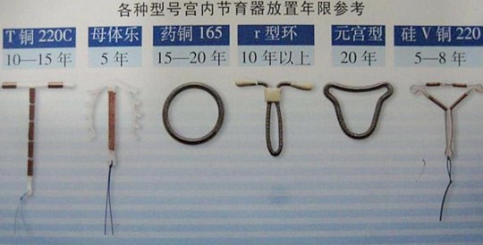 阴避孕环,节育环的形状图片有几种