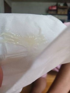 黄到下面流透明液体,白带黄后来透明怎么回事
