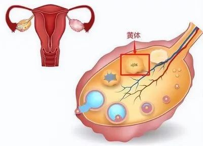 黄体囊肿是怎么回事,黄体囊肿是什么