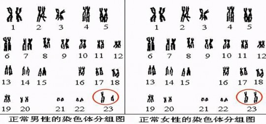 性染色体异常能做试管吗性染色体可能异常不做穿刺吗