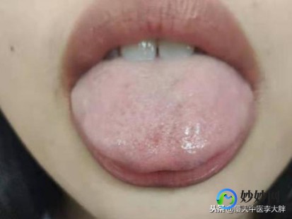 附件囊肿是怎么形成的,附件为什么有囊肿