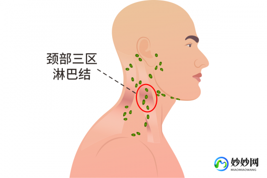 颈部淋巴结,脖子上有淋巴结吗