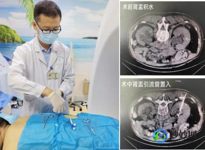 透析疼吗,透析有多痛苦
