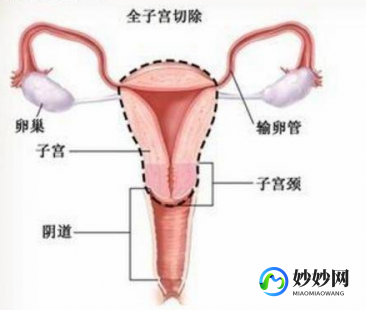 切除子宫不能怀孕吗吗、子宫切除不能怀孕了吗