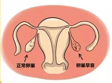 卵巢早衰停经能试管吗卵巢早衰闭经能做试管吗
