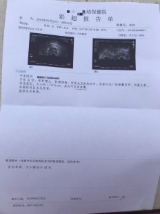 试管不成功需要做宫腔镜(试管不成功需要做宫腔镜吗)