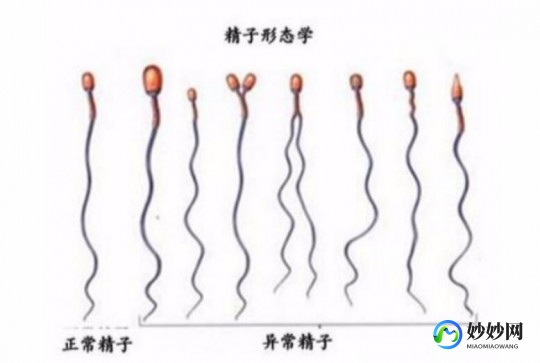 畸形弱精能直接试管吗畸形精子弱精试管能成功吗